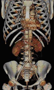 CT Angiography Figure 1