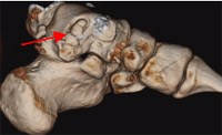 Multiplanar Musculokeletal CT Figure 4